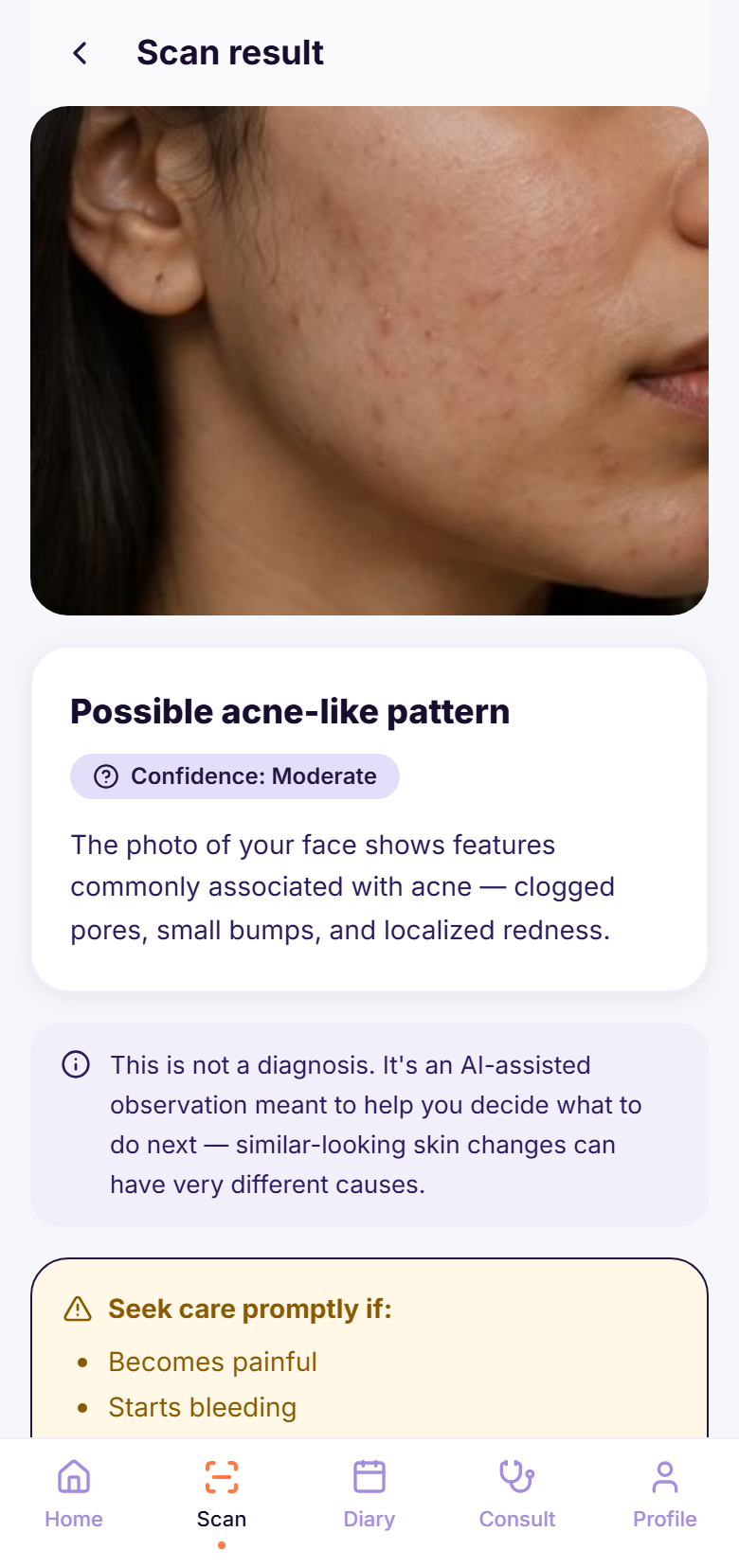 DermaShopey AI result screen
